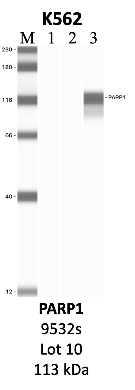 CST_9532S_10_PARP1.png<br>Caption: IP-WB analysis of 9532S whole cell lysate using the PARP1 specific antibody, 9532S. Lanes 1 and 2 are 2.5% of five million whole cell lysate input and 50% of IP enrichment, respectively, using a normal IgG antibody. Lane 3 is 50% of IP enrichment from five million whole cell lysate using the PARP1-specific antibody, 9532S. The same antibody was used to detect protein levels via Western blot. This antibody passes preliminary validation and will be further pursued for secondary validation. *NOTE* Protein sizes are taken from Genecards.org and are only estimates based on sequence. Actual protein size may differ based on protein characteristics and electrophoresis method used.