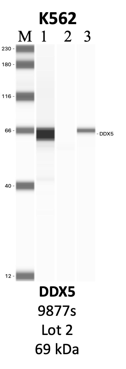 CST_9877S_2_DDX5.png<br>Caption: IP-WB analysis of 9877S whole cell lysate using the DDX5 specific antibody, 9877S. Lanes 1 and 2 are 2.5% of five million whole cell lysate input and 50% of IP enrichment, respectively, using a normal IgG antibody. Lane 3 is 50% of IP enrichment from five million whole cell lysate using the DDX5-specific antibody, 9877S. The same antibody was used to detect protein levels via Western blot. This antibody passes preliminary validation and will be further pursued for secondary validation. *NOTE* Protein sizes are taken from Genecards.org and are only estimates based on sequence. Actual protein size may differ based on protein characteristics and electrophoresis method used.