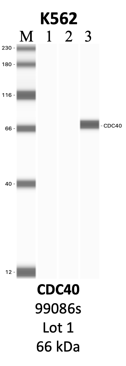 CST_99086S_1_CDC40.png<br>Caption: IP-WB analysis of 99086S whole cell lysate using the CDC40 specific antibody, 99086S. Lanes 1 and 2 are 2.5% of five million whole cell lysate input and 50% of IP enrichment, respectively, using a normal IgG antibody. Lane 3 is 50% of IP enrichment from five million whole cell lysate using the CDC40-specific antibody, 99086S. The same antibody was used to detect protein levels via Western blot. This antibody passes preliminary validation and will be further pursued for secondary validation. *NOTE* Protein sizes are taken from Genecards.org and are only estimates based on sequence. Actual protein size may differ based on protein characteristics and electrophoresis method used.