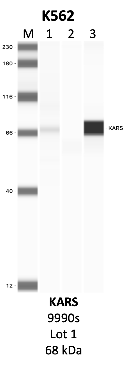 CST_9990S_1_KARS.png<br>Caption: IP-WB analysis of 9990S whole cell lysate using the KARS specific antibody, 9990S. Lanes 1 and 2 are 2.5% of five million whole cell lysate input and 50% of IP enrichment, respectively, using a normal IgG antibody. Lane 3 is 50% of IP enrichment from five million whole cell lysate using the KARS-specific antibody, 9990S. The same antibody was used to detect protein levels via Western blot. This antibody passes preliminary validation and will be further pursued for secondary validation. *NOTE* Protein sizes are taken from Genecards.org and are only estimates based on sequence. Actual protein size may differ based on protein characteristics and electrophoresis method used.