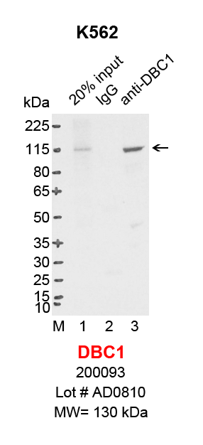 DBC1_K562.png<br>Caption: IP-Western Blot analysis of K562 whole cell lysate using DBC1 specific antibody. Lane 1 is 4% of ten million whole cell lysate input (lane under '20% input') , lane 2 is 20% of IP enrichment using mouse normal IgG (lane under 'IgG') and lane 3 is 20% IP enrichment using mouse monoclonal anti-DBC1 antibody (lanes under 'anti-DBC1').