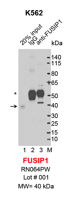 FUSIP1_K562.png<br>Caption: IP-Western Blot analysis of K562 whole cell lysate using SRSF10/FUSIP1 specific antibody. Lane 1 is 4% of ten million whole cell lysate input (lane under '20% input') , lane 2 is 20% of IP enrichment using rabbit normal IgG (lane under 'IgG') and lane 3 is 20% IP enrichment using rabbit polyclonal anti-SRSF10/FUSIP1 antibody (lanes under 'anti-SRSF10'). Asterisk indicates heavy chain of antibody.