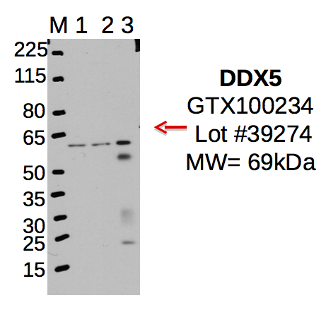 GeneTex_GTX100234_39274_DDX5.png<br>Caption: IP-WB characterization of DDX5 specific antibody in K562 cell line . Lane 1 is 2.5% of five million K562 whole cell lysate Input, lane 2 is 2.5% of supernatant after immunoprecipitation and Lane 3 is 50% of IP enrichment using rabbit polyclonal Anti-DDX5 antibody. This antibody passes preliminary validation and will be further pursued for primary and secondary validation.