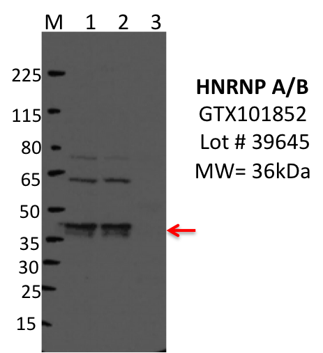 GeneTex_GTX101852_39645_HNRNPAB.png<br>Caption: IP-WB characterization of HNRNPAB specific antibody in K562 cell line . Lane 1 is 2.5% of five million K562 whole cell lysate Input, lane 2 is 2.5% of supernatant after immunoprecipitation and Lane 3 is 50% of IP enrichment using rabbit polyclonal hnRNPA/B antibody. This antibody did not meet our primary validation criteria using our standard IP protocol in the indicated cell type.