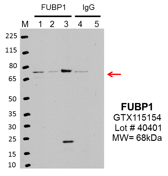 GeneTex_GTX115154_40401_FUBP1.png<br>Caption: IP-Western blot analysis of K562 whole cell lysate using FUBP1 specific antibody. Lane 1 and lane 4 are 2.5% of 0.5mg input lysate, lane 2 is 2.5% of supernatant after immunoprecipitation using FUBP1 antibody, Lane 3 is 50% of IP enrichment using rabbit polyclonal FUBP1 antibody and lane 5 is 50% of IP enrichement using rabbit normal IgG control antibody. This antibody passes preliminary validation and will be further pursued for primary and secondary validation.