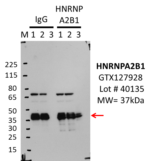 GeneTex_GTX127928_40135_HNRNPA2B1_K562.png<br>Caption: IP-Western Blot analysis of K562 whole cell lysate using HNRNPA2B1 specific antibody. Lane 1 is 2.5% of 0.5mg input lysate, lane 2 is 2.5% of supernatant after immunoprecipitation and Lane 3 is 50% of IP enrichment using either rabbit polyclonal anti-hnRNP A2B1 antibody (lanes under 'HNRNP A2B1') or using rabbit normal IgG (lanes under 'IgG'). This antibody did not meet our primary validation criteria using our standard IP protocol in the indicated cell type.