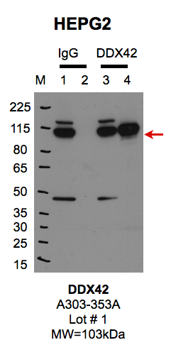 HEPG2_BETHYL_A303353A_1_DDX42.png<br>Caption: IP-Western Blot analysis of HepG2 whole cell lysate using DDX42 specific antibody. Lane 1 is 1% of twenty million whole cell lysate input and lane 2 is 25% of IP enrichment using rabbit normal IgG (lanes under 'IgG'). Lane 3 is 1% of twenty million whole cell lysate input and lane 4 is 10% IP enrichment using rabbit polyclonal anti-DDX42 antibody (lanes under 'DDX42').