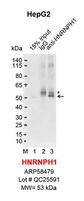 HNRNPH1_HepG2.png<br>Caption: IP-Western Blot analysis of HepG2 whole cell lysate using HNRNPH1 specific antibody. Lane 1 is 3% of ten million whole cell lysate input (lane under '15% input') , lane 2 is 20% of IP enrichment using rabbit normal IgG (lane under 'IgG') and lane 3 is 20% IP enrichment using rabbit polyclonal anti-HNRNPH1 antibody (lanes under 'anti-HNRNPH1'). Asterisk indicates heavy chain of antibody.