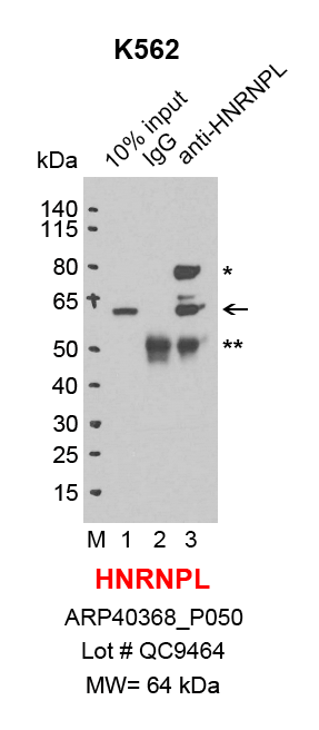 HNRNPL_K562.png<br>Caption: IP-Western Blot analysis of K562 whole cell lysate using HNRNPL specific antibody. Lane 1 is 2% of ten million whole cell lysate input (lane under '10% input') , lane 2 is 20% of IP enrichment using rabbit normal IgG (lane under 'IgG') and lane 3 is 20% IP enrichment using rabbit polyclonal anti-HNRNPL antibody (lanes under 'anti-HNRNPL'). Asterisk indicates non-specific band and double asterisk indiecates heavy chain of antibody.