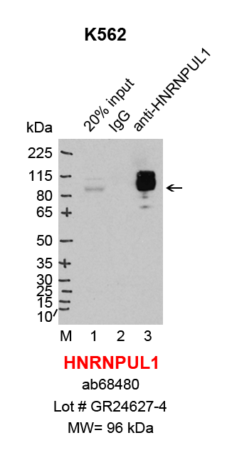 HNRNPUL1_abcam_K562.png<br>Caption: IP-Western Blot analysis of K562 whole cell lysate using HNRNPUL1 specific antibody. Lane 1 is 1% of ten million whole cell lysate input (lane under '20% input') , lane 2 is 5% of IP enrichment using rabbit normal IgG (lane under 'IgG') and lane 3 is 5% IP enrichment using rabbit monoclonal anti-HNRNPUL1 antibody (lanes under 'anti-HNRNPUL1').