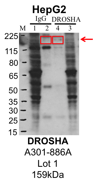 HepG2_A301-886A_1_DROSHA_MassSpec.png<br>Caption: Representative image of immunoprecipitation performed on whole cell extracts from the HepG2 cell line using the DROSHA-specific antibody A301-886A. Lane 1: Input from IP using control IgG. Lane 2: Immunoprecipitated material using control IgG. Lane 3: Input from IP using DROSHA antibody. Lane 4: Immunoprecipitated material using DROSHA antibody. Outlined regions were excised from gel and subjected to analysis by mass spectrometry. Target molecular weight: 159.32 kDa.