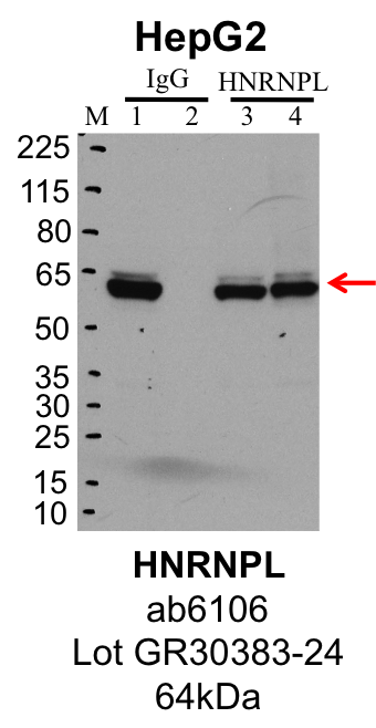 HepG2_Abcam_ab6106_GR30383-24_HNRNPL.png<br>Caption: IP-Western Blot analysis of HepG2 whole cell lysate using HNRNPL specific antibody. Lane 1 is 1% of twenty million whole cell lysate input and lane 2 is 25% of IP enrichment using rabbit normal IgG (lanes under 'IgG'). Lane 3 is 1% of twenty million whole cell lysate input and lane 4 is 10% IP enrichment using rabbit polyclonal anti-HNRNPL antibody (lanes under 'HNRNPL').