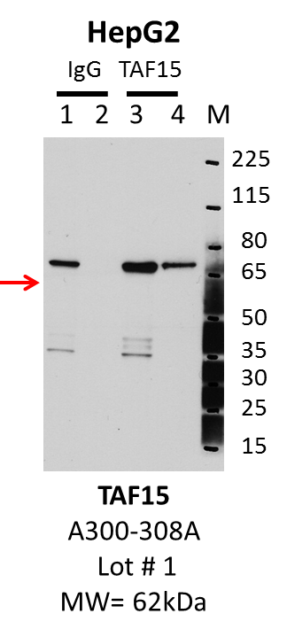 HepG2_Bethyl_A300-308A_1_TAF15.png<br>Caption: IP-Western Blot analysis of HepG2 whole cell lysate using TAF15 specific antibody. Lane 1 is 1% of twenty million whole cell lysate input and lane 2 is 25% of IP enrichment using rabbit normal IgG (lanes under 'IgG'). Lane 3 is 1% of twenty million whole cell lysate input and lane 4 is 10% IP enrichment using rabbit polyclonal anti-TAF15 antibody (lanes under 'TAF15').