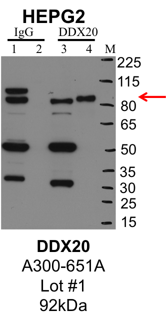 HepG2_Bethyl_A300-651A_1_DDX20.png<br>Caption: IP-Western Blot analysis of HepG2 whole cell lysate using DDX20 specific antibody. Lane 1 is 1% of twenty million whole cell lysate input and lane 2 is 25% of IP enrichment using rabbit normal IgG (lanes under 'IgG'). Lane 3 is 1% of twenty million whole cell lysate input and lane 4 is 10% IP enrichment using rabbit polyclonal anti-DDX20 antibody (lanes under 'DDX20').