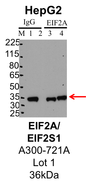 HepG2_Bethyl_A300-721A_1_EIF2S1.png<br>Caption: IP-Western Blot analysis of HepG2 whole cell lysate using EIF2S1 specific antibody. Lane 1 is 1% of twenty million whole cell lysate input and lane 2 is 25% of IP enrichment using rabbit normal IgG (lanes under 'IgG'). Lane 3 is 1% of twenty million whole cell lysate input and lane 4 is 10% IP enrichment using rabbit polyclonal anti-EIF2S1 antibody (lanes under 'EIF2S1').