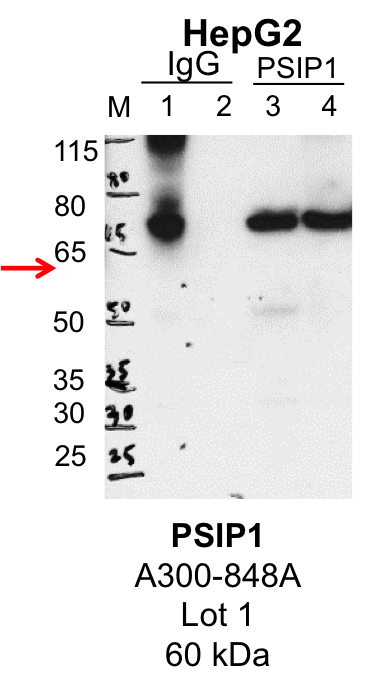 HepG2_Bethyl_A300-848A_1_PSIP1.png<br>Caption: IP-Western Blot analysis of HepG2 whole cell lysate using PSIP1 specific antibody. Lane 1 is 1% of twenty million whole cell lysate input and lane 2 is 25% of IP enrichment using rabbit normal IgG (lanes under 'IgG'). Lane 3 is 1% of twenty million whole cell lysate input and lane 4 is 10% IP enrichment using rabbit polyclonal anti-PSIP1 antibody (lanes under 'PSIP1').