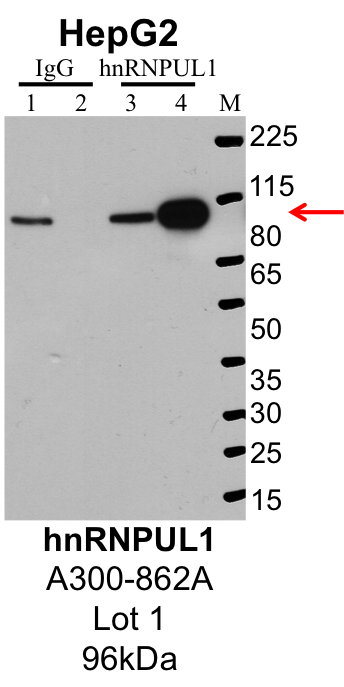 HepG2_Bethyl_A300-862A_1_hnRNPUL1.png<br>Caption: IP-Western Blot analysis of HepG2 whole cell lysate using HNRNPUL1 specific antibody. Lane 1 is 1% of twenty million whole cell lysate input and lane 2 is 25% of IP enrichment using rabbit normal IgG (lanes under 'IgG'). Lane 3 is 1% of twenty million whole cell lysate input and lane 4 is 10% IP enrichment using rabbit polyclonal anti-HNRNPUL1 antibody (lanes under 'HNRNPUL1').