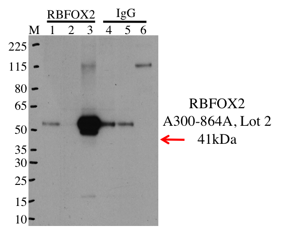 HepG2_Bethyl_A300-864A_2_RBFOX2.png<br>Caption: IP-Western Blot analysis of HepG2 whole cell lysate using IGF2BP1 specific antibody. Lane 1 is 1% of twenty million whole cell lysate input, lane 2 is 1% of supernatant after IP and lane 3 is 10% of IP enrichment using rabbit polyclonal anti-RBFOX2 antibody (lanes under 'RBFOX2'). Lanes 4, 5 and 6 are in the same pattern but using rabbit normal IgG for IP (lanes under 'IgG').