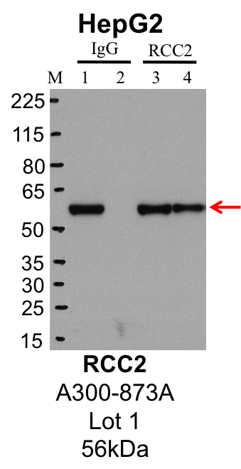 HepG2_Bethyl_A300-873A_1_RCC2.png<br>Caption: IP-Western Blot analysis of HepG2 whole cell lysate using RCC2 specific antibody. Lane 1 is 1% of twenty million whole cell lysate input and lane 2 is 25% of IP enrichment using rabbit normal IgG (lanes under 'IgG'). Lane 3 is 1% of twenty million whole cell lysate input and lane 4 is 10% IP enrichment using rabbit polyclonal anti-RCC2 antibody (lanes under 'RCC2').