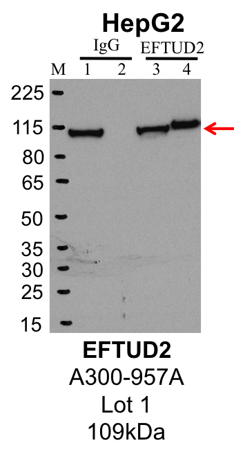 HepG2_Bethyl_A300-957A_1_EFTUD2.png<br>Caption: IP-Western Blot analysis of HepG2 whole cell lysate using EFTUD2 specific antibody. Lane 1 is 1% of twenty million whole cell lysate input and lane 2 is 25% of IP enrichment using rabbit normal IgG (lanes under 'IgG'). Lane 3 is 1% of twenty million whole cell lysate input and lane 4 is 10% IP enrichment using rabbit polyclonal anti-EFTUD2 antibody (lanes under 'EFTUD2').