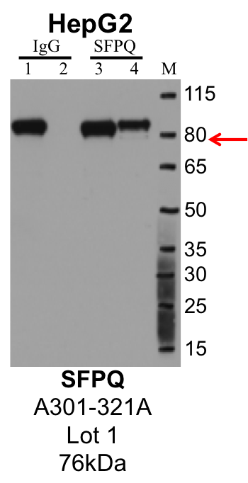 HepG2_Bethyl_A301-321A_1_SFPQ.png<br>Caption: IP-Western Blot analysis of HepG2 whole cell lysate using SFPQ specific antibody. Lane 1 is 1% of twenty million whole cell lysate input and lane 2 is 10% of IP enrichment using rabbit normal IgG (lanes under 'IgG'). Lane 3 is 1% of twenty million whole cell lysate input and lane 4 is 10% IP enrichment using rabbit polyclonal anti-SFPQ antibody (lanes under 'SFPQ').