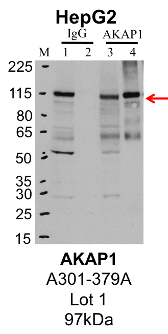 HepG2_Bethyl_A301-379A_1_AKAP1.png<br>Caption: IP-Western Blot analysis of HepG2 whole cell lysate using AKAP1 specific antibody. Lane 1 is 1% of twenty million whole cell lysate input and lane 2 is 25% of IP enrichment using rabbit normal IgG (lanes under 'IgG'). Lane 3 is 1% of twenty million whole cell lysate input and lane 4 is 10% IP enrichment using rabbit polyclonal anti-AKAP1 antibody (lanes under 'AKAP1').