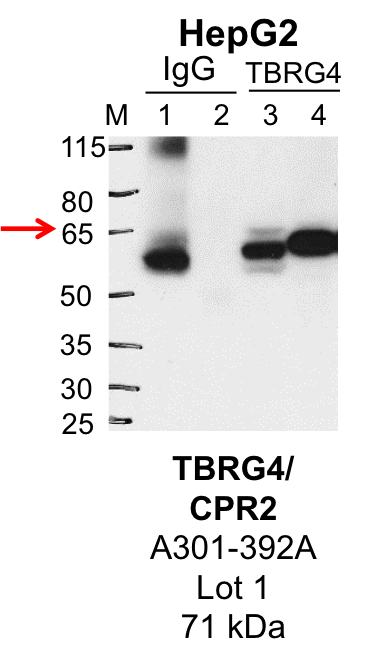 HepG2_Bethyl_A301-392A_1_TBRG4.png<br>Caption: IP-Western Blot analysis of HepG2 whole cell lysate using TBRG4 specific antibody. Lane 1 is 1% of twenty million whole cell lysate input and lane 2 is 25% of IP enrichment using rabbit normal IgG (lanes under 'IgG'). Lane 3 is 1% of twenty million whole cell lysate input and lane 4 is 10% IP enrichment using rabbit polyclonal anti-TBRG4 antibody (lanes under 'TBRG4').