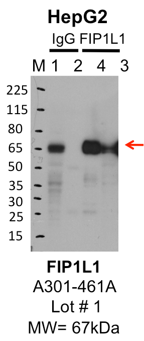 HepG2_Bethyl_A301-461A_1_FIP1L1.png<br>Caption: IP-Western Blot analysis of HepG2 whole cell lysate using FIP1L1 specific antibody. Lane 1 is 1% of twenty million whole cell lysate input and lane 2 is 25% of IP enrichment using rabbit normal IgG (lanes under 'IgG'). Lane 3 is 1% of twenty million whole cell lysate input and lane 4 is 10% IP enrichment using rabbit polyclonal anti-FIP1L1 antibody (lanes under 'FIP1L1').