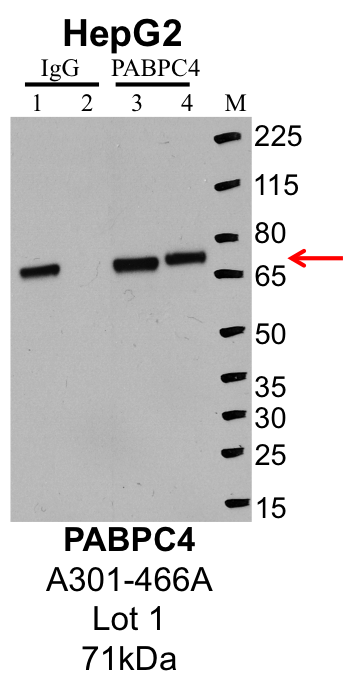 HepG2_Bethyl_A301-466A_1_PABPC4.png<br>Caption: IP-Western Blot analysis of HepG2 whole cell lysate using PABPC4 specific antibody. Lane 1 is 1% of twenty million whole cell lysate input and lane 2 is 25% of IP enrichment using rabbit normal IgG (lanes under 'IgG'). Lane 3 is 1% of twenty million whole cell lysate input and lane 4 is 10% IP enrichment using rabbit polyclonal anti-PABPC4 antibody (lanes under 'PABPC4').