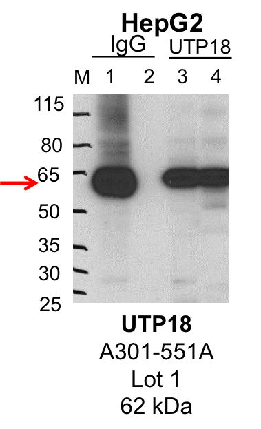 HepG2_Bethyl_A301-551A_1_UTP18.png<br>Caption: IP-Western Blot analysis of HepG2 whole cell lysate using UTP18 specific antibody. Lane 1 is 1% of twenty million whole cell lysate input and lane 2 is 25% of IP enrichment using rabbit normal IgG (lanes under 'IgG'). Lane 3 is 1% of twenty million whole cell lysate input and lane 4 is 10% IP enrichment using rabbit polyclonal anti-UTP18 antibody (lanes under 'UTP18').