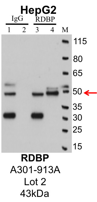 HepG2_Bethyl_A301-913A_2_RDBP.png<br>Caption: IP-Western Blot analysis of HepG2 whole cell lysate using RDBP specific antibody. Lane 1 is 1% of twenty million whole cell lysate input and lane 2 is 25% of IP enrichment using rabbit normal IgG (lanes under 'IgG'). Lane 3 is 1% of twenty million whole cell lysate input and lane 4 is 10% IP enrichment using rabbit polyclonal anti-RDBP antibody (lanes under 'RDBP').