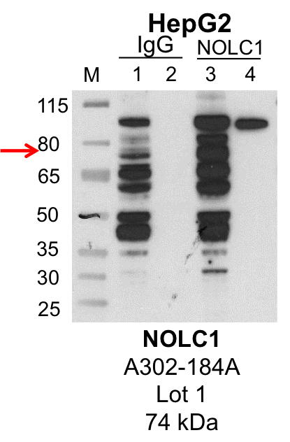 HepG2_Bethyl_A302-184A_1_NOLC1.png<br>Caption: IP-Western Blot analysis of HepG2 whole cell lysate using NOLC1 specific antibody. Lane 1 is 1% of twenty million whole cell lysate input and lane 2 is 25% of IP enrichment using rabbit normal IgG (lanes under 'IgG'). Lane 3 is 1% of twenty million whole cell lysate input and lane 4 is 10% IP enrichment using rabbit polyclonal anti-NOLC1 antibody (lanes under 'NOLC1').