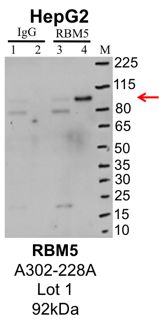 HepG2_Bethyl_A302-228A_1_RBM5.png<br>Caption: IP-Western Blot analysis of HepG2 whole cell lysate using RBM5 specific antibody. Lane 1 is 1% of twenty million whole cell lysate input and lane 2 is 25% of IP enrichment using rabbit normal IgG (lanes under 'IgG'). Lane 3 is 1% of twenty million whole cell lysate input and lane 4 is 10% IP enrichment using rabbit polyclonal anti-RBM5 antibody (lanes under 'RBM5').