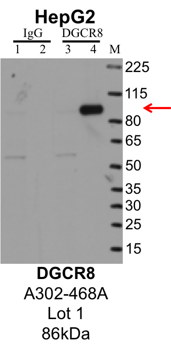 HepG2_Bethyl_A302-468A_1_DGCR8.png<br>Caption: IP-Western Blot analysis of HepG2 whole cell lysate using DGCR8 specific antibody. Lane 1 is 1% of twenty million whole cell lysate input and lane 2 is 25% of IP enrichment using rabbit normal IgG (lanes under 'IgG'). Lane 3 is 1% of twenty million whole cell lysate input and lane 4 is 10% IP enrichment using rabbit polyclonal anti-DGCR8 antibody (lanes under 'DGCR8').