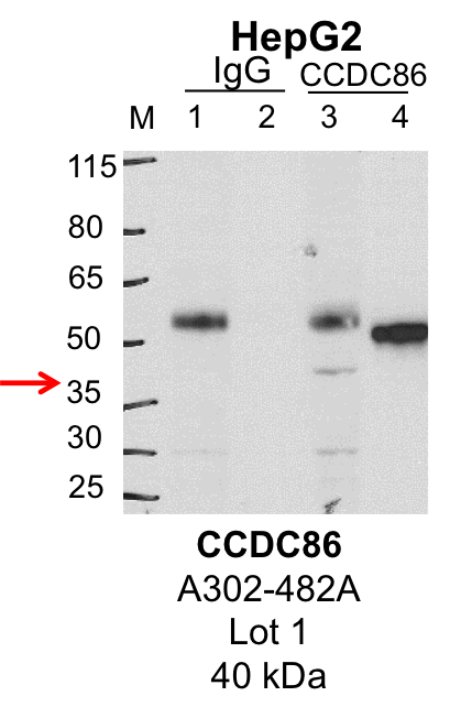 HepG2_Bethyl_A302-482A_1_CCDC86.png<br>Caption: IP-Western Blot analysis of HepG2 whole cell lysate using CCDC86 specific antibody. Lane 1 is 1% of twenty million whole cell lysate input and lane 2 is 25% of IP enrichment using rabbit normal IgG (lanes under 'IgG'). Lane 3 is 1% of twenty million whole cell lysate input and lane 4 is 10% IP enrichment using rabbit polyclonal anti-CCDC86 antibody (lanes under 'CCDC86').