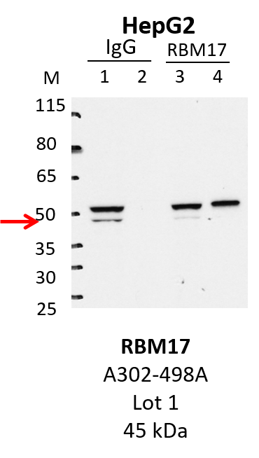 HepG2_Bethyl_A302-498A_1_RBM17.png<br>Caption: IP-Western Blot analysis of HepG2 whole cell lysate using RBM17 specific antibody. Lane 1 is 1% of twenty million whole cell lysate input and lane 2 is 25% of IP enrichment using rabbit normal IgG (lanes under 'IgG'). Lane 3 is 1% of twenty million whole cell lysate input and lane 4 is 10% IP enrichment using rabbit polyclonal anti-RBM17 antibody (lanes under 'RBM17').