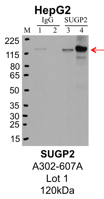 HepG2_Bethyl_A302-607A_1_SUGP2.png<br>Caption: IP-Western Blot analysis of HepG2 whole cell lysate using SUGP2 specific antibody. Lane 1 is 1% of twenty million whole cell lysate input and lane 2 is 25% of IP enrichment using rabbit normal IgG (lanes under 'IgG'). Lane 3 is 1% of twenty million whole cell lysate input and lane 4 is 10% IP enrichment using rabbit polyclonal anti-SUGP2 antibody (lanes under 'SUGP2').