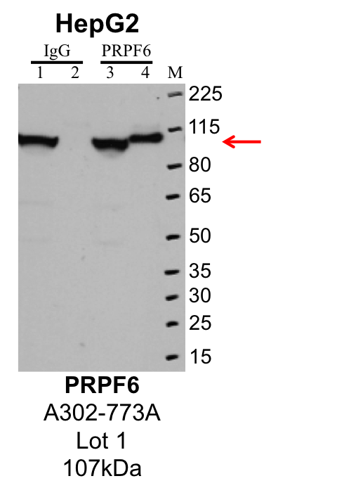 HepG2_Bethyl_A302-773A_1_PRPF6.png<br>Caption: IP-Western Blot analysis of HepG2 whole cell lysate using PRPF6 specific antibody. Lane 1 is 1% of twenty million whole cell lysate input and lane 2 is 25% of IP enrichment using rabbit normal IgG (lanes under 'IgG'). Lane 3 is 1% of twenty million whole cell lysate input and lane 4 is 10% IP enrichment using rabbit polyclonal anti-PRPF6 antibody (lanes under 'PRPF6').