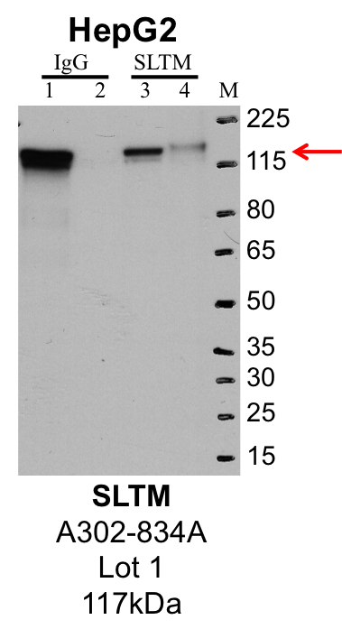 HepG2_Bethyl_A302-834A_1_SLTM.png<br>Caption: IP-Western Blot analysis of HepG2 whole cell lysate using SLTM specific antibody. Lane 1 is 1% of twenty million whole cell lysate input and lane 2 is 25% of IP enrichment using rabbit normal IgG (lanes under 'IgG'). Lane 3 is 1% of twenty million whole cell lysate input and lane 4 is 10% IP enrichment using rabbit polyclonal anti-SLTM antibody (lanes under 'SLTM').