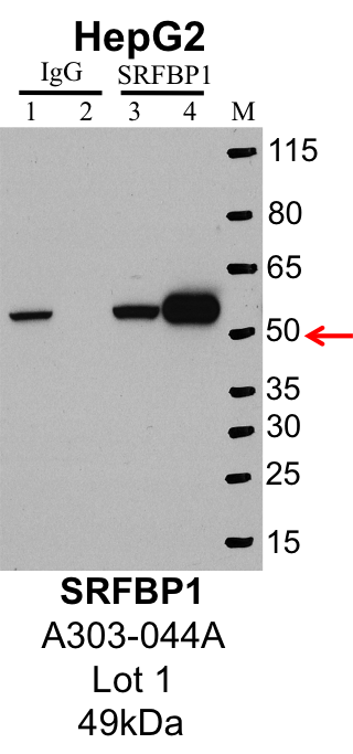 HepG2_Bethyl_A303-044A_1_SRFBP1.png<br>Caption: IP-Western Blot analysis of HepG2 whole cell lysate using SRFBP1 specific antibody. Lane 1 is 1% of twenty million whole cell lysate input and lane 2 is 25% of IP enrichment using rabbit normal IgG (lanes under 'IgG'). Lane 3 is 1% of twenty million whole cell lysate input and lane 4 is 10% IP enrichment using rabbit polyclonal anti-SRFBP1 antibody (lanes under 'SRFBP1').