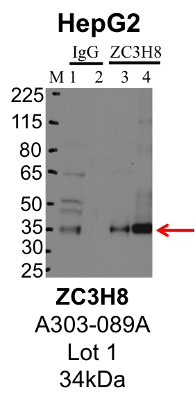 HepG2_Bethyl_A303-089A_1_ZC3H8.png<br>Caption: IP-Western Blot analysis of HepG2 whole cell lysate using ZC3H8 specific antibody. Lane 1 is 1% of twenty million whole cell lysate input and lane 2 is 25% of IP enrichment using rabbit normal IgG (lanes under 'IgG'). Lane 3 is 1% of twenty million whole cell lysate input and lane 4 is 10% IP enrichment using rabbit polyclonal anti-ZC3H8 antibody (lanes under 'ZC3H8').