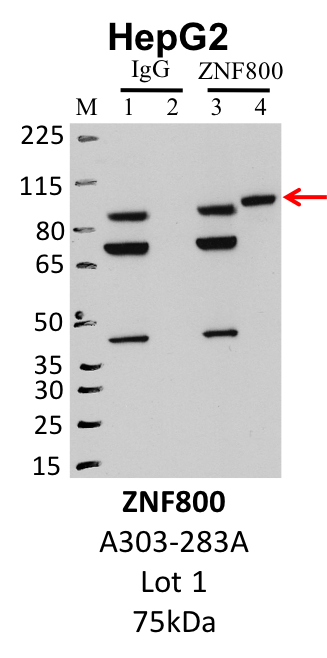 HepG2_Bethyl_A303-283A_1_ZNF800_2.png<br>Caption: IP-Western Blot analysis of HepG2 whole cell lysate using ZNF800 specific antibody. Lane 1 is 1% of twenty million whole cell lysate input and lane 2 is 25% of IP enrichment using rabbit normal IgG (lanes under 'IgG'). Lane 3 is 1% of twenty million whole cell lysate input and lane 4 is 10% IP enrichment using rabbit polyclonal anti-ZNF800 antibody (lanes under 'ZNF800').