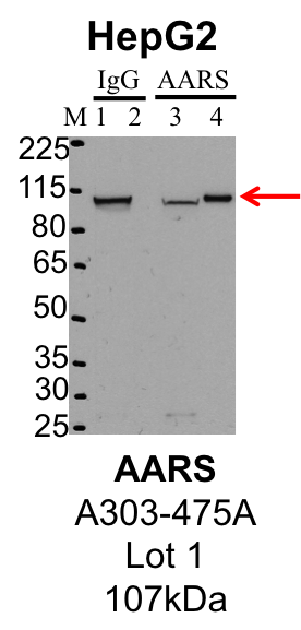 HepG2_Bethyl_A303-475A_1_AARS.png<br>Caption: IP-Western Blot analysis of HepG2 whole cell lysate using AARS specific antibody. Lane 1 is 1% of twenty million whole cell lysate input and lane 2 is 25% of IP enrichment using rabbit normal IgG (lanes under 'IgG'). Lane 3 is 1% of twenty million whole cell lysate input and lane 4 is 10% IP enrichment using rabbit polyclonal anti-AARS antibody (lanes under 'AARS').