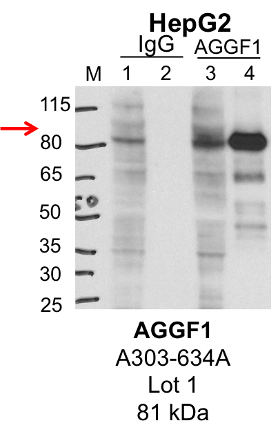 HepG2_Bethyl_A303-634A_1_AGGF1.png<br>Caption: IP-Western Blot analysis of HepG2 whole cell lysate using AGGF1 specific antibody. Lane 1 is 1% of twenty million whole cell lysate input and lane 2 is 25% of IP enrichment using rabbit normal IgG (lanes under 'IgG'). Lane 3 is 1% of twenty million whole cell lysate input and lane 4 is 10% IP enrichment using rabbit polyclonal anti-AGGF1 antibody (lanes under 'AGGF1').