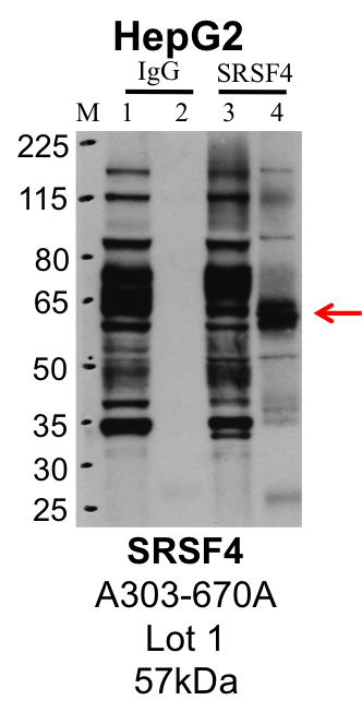 HepG2_Bethyl_A303-670A_1_SRSF4.png<br>Caption: IP-Western Blot analysis of HepG2 whole cell lysate using SRSF4 specific antibody. Lane 1 is 1% of twenty million whole cell lysate input and lane 2 is 25% of IP enrichment using rabbit normal IgG (lanes under 'IgG'). Lane 3 is 1% of twenty million whole cell lysate input and lane 4 is 10% IP enrichment using rabbit polyclonal anti-SRSF4 antibody (lanes under 'SRSF4').