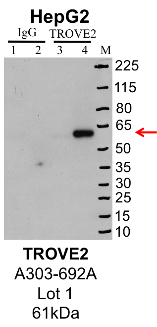 HepG2_Bethyl_A303-692A_1_TROVE2.png<br>Caption: IP-Western Blot analysis of HepG2 whole cell lysate using TROVE2 specific antibody. Lane 1 is 1% of twenty million whole cell lysate input and lane 2 is 25% of IP enrichment using rabbit normal IgG (lanes under 'IgG'). Lane 3 is 1% of twenty million whole cell lysate input and lane 4 is 10% IP enrichment using rabbit polyclonal anti-TROVE2 antibody (lanes under 'TROVE2').