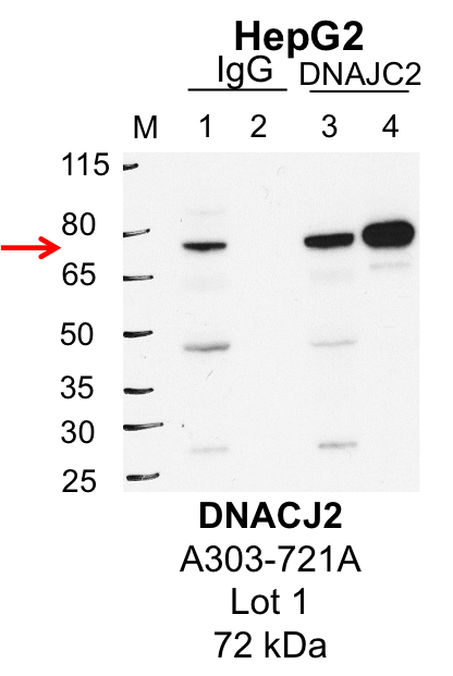 HepG2_Bethyl_A303-721A_1_DNAJC2.png<br>Caption: IP-Western Blot analysis of HepG2 whole cell lysate using DNAJC2 specific antibody. Lane 1 is 1% of twenty million whole cell lysate input and lane 2 is 25% of IP enrichment using rabbit normal IgG (lanes under 'IgG'). Lane 3 is 1% of twenty million whole cell lysate input and lane 4 is 10% IP enrichment using rabbit polyclonal anti-DNAJC2 antibody (lanes under 'DNAJC2').