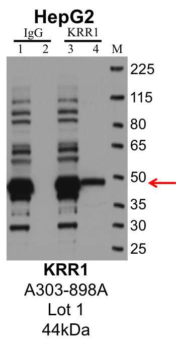 HepG2_Bethyl_A303-898A_1_KRR1.png<br>Caption: IP-Western Blot analysis of HepG2 whole cell lysate using KRR1 specific antibody. Lane 1 is 1% of twenty million whole cell lysate input and lane 2 is 10% of IP enrichment using rabbit normal IgG (lanes under 'IgG'). Lane 3 is 1% of twenty million whole cell lysate input and lane 4 is 10% IP enrichment using rabbit polyclonal anti-KRR1 antibody (lanes under 'KRR1').