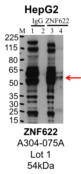 HepG2_Bethyl_A304-075A_1_ZNF622.png<br>Caption: IP-Western Blot analysis of HepG2 whole cell lysate using ZNF622 specific antibody. Lane 1 is 1% of twenty million whole cell lysate input and lane 2 is 25% of IP enrichment using rabbit normal IgG (lanes under 'IgG'). Lane 3 is 1% of twenty million whole cell lysate input and lane 4 is 10% IP enrichment using rabbit polyclonal anti-ZNF622 antibody (lanes under 'ZNF622').