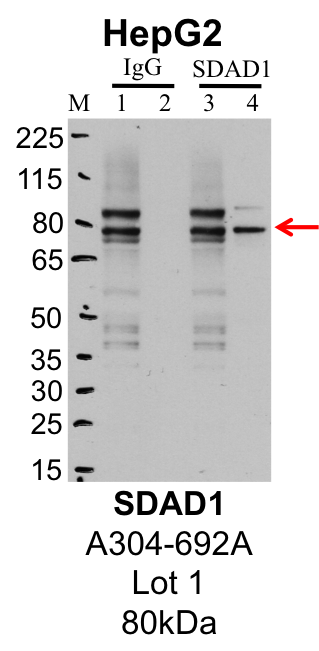 HepG2_Bethyl_A304-692A_1_SDAD1.png<br>Caption: IP-Western Blot analysis of HepG2 whole cell lysate using SDAD1 specific antibody. Lane 1 is 1% of twenty million whole cell lysate input and lane 2 is 25% of IP enrichment using rabbit normal IgG (lanes under 'IgG'). Lane 3 is 1% of twenty million whole cell lysate input and lane 4 is 10% IP enrichment using rabbit polyclonal anti-SDAD1 antibody (lanes under 'SDAD1').